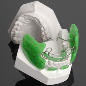 apparecchio ortodontico per bambini